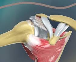 השתלת בלון בניתוח